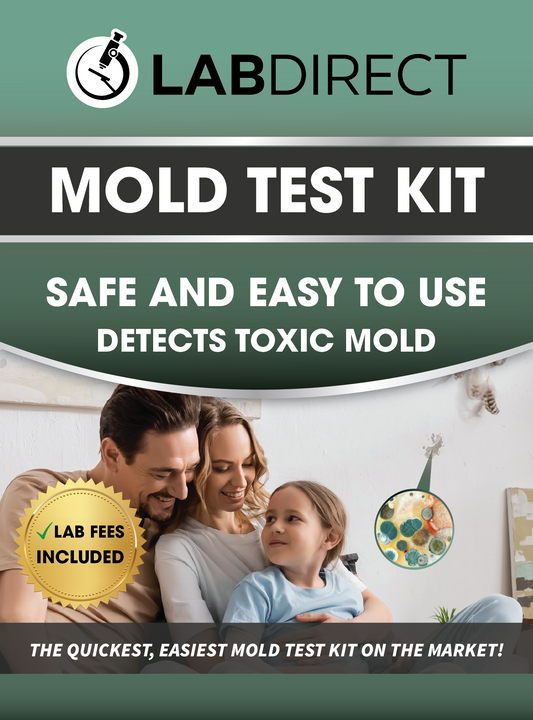 The LabDirect Mold Test Kit is easy to use and comes with clear instructions featuring four comprehensive testing methods in one convenient package. Click or tap on the image for product details. The lab analysis fee is included.